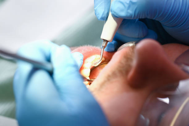 Best Broken or Chipped Tooth Repair in Pumpkin Center, NC