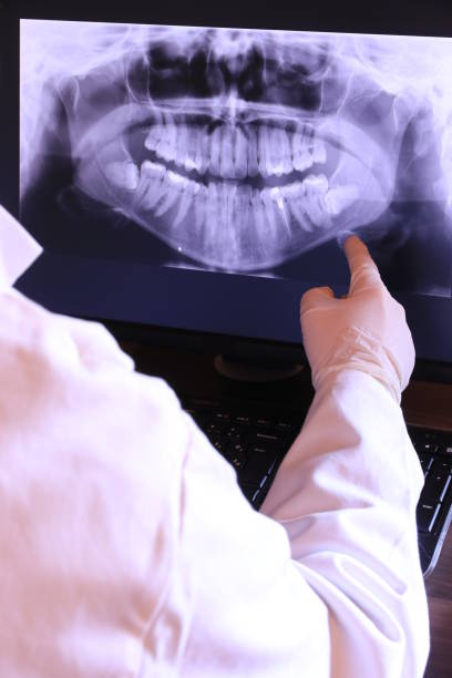 Best Emergency Root Canal Therapy in Pumpkin Center, NC